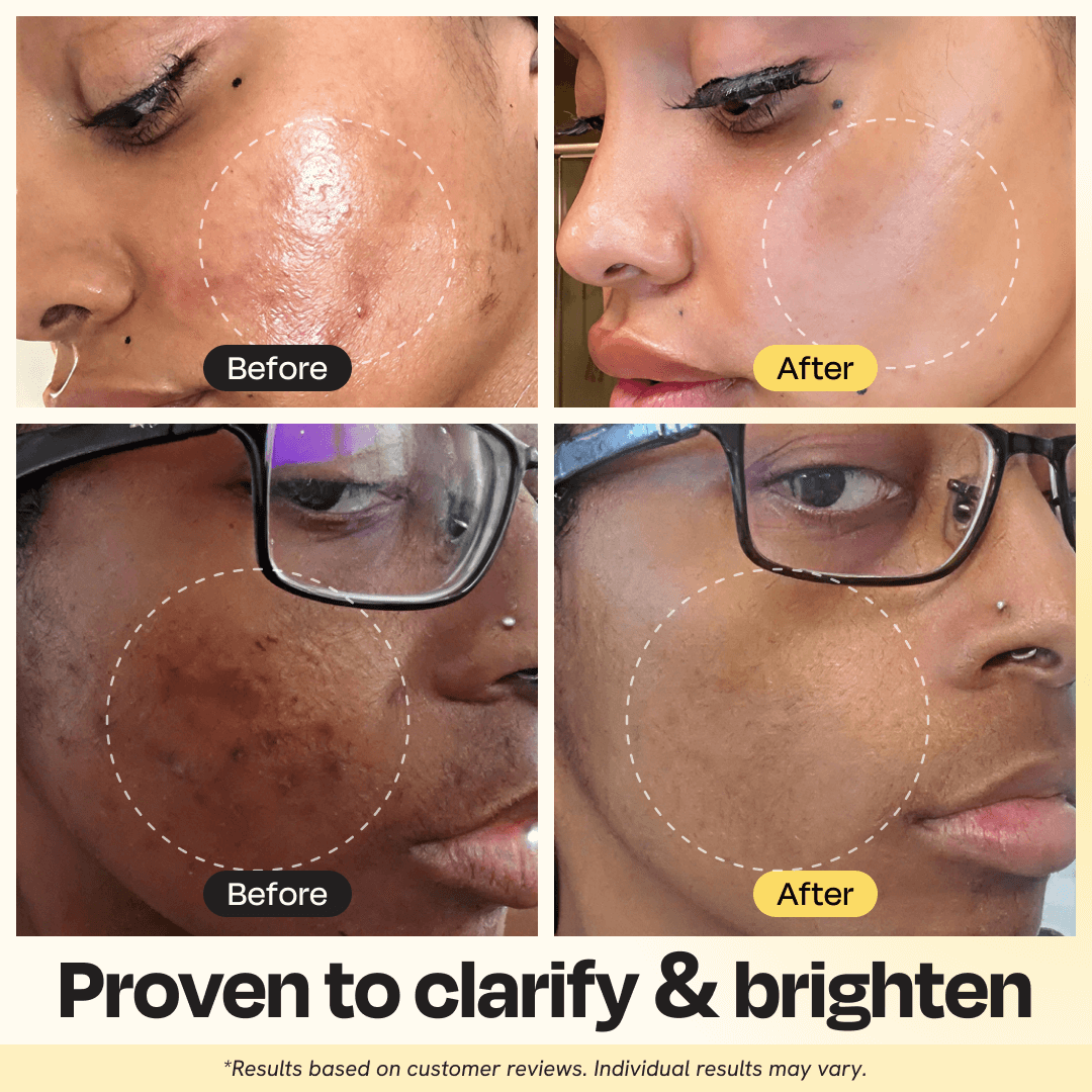 Vitamin C Clay Mask